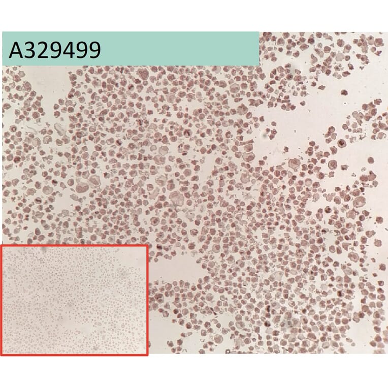 Immunohistochemistry - Anti-Glypican 3 Antibody [163D11] (A332361) - Antibodies.com