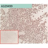 Immunohistochemistry - Anti-Glypican 3 Antibody [163D11] (A332361) - Antibodies.com