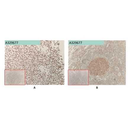 Immunohistochemistry - Anti-FCRL5 Antibody [1A11] (A332539) - Antibodies.com