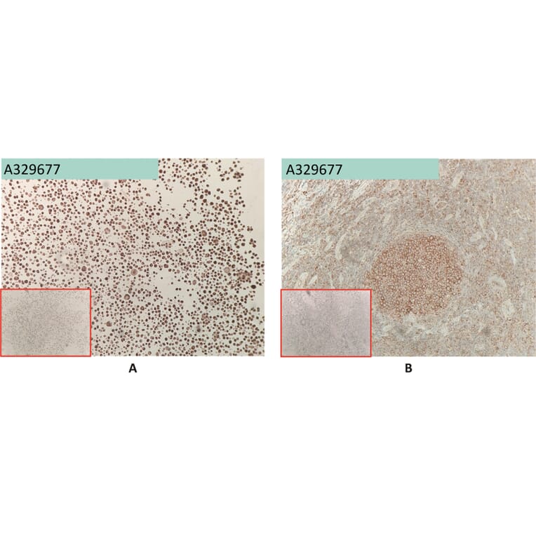 Immunohistochemistry - Anti-FCRL5 Antibody [1A11] (A332539) - Antibodies.com