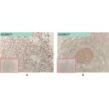 Immunohistochemistry - Anti-FCRL5 Antibody [1A11] (A332539) - Antibodies.com