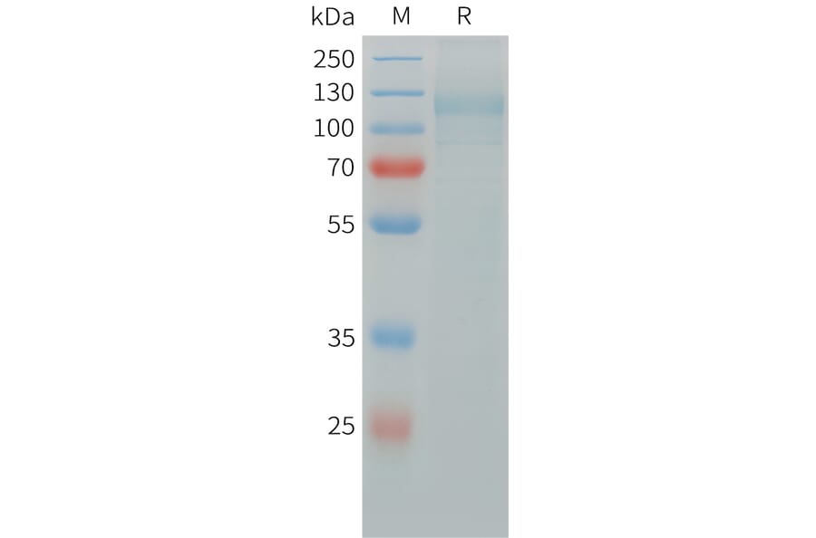 SDS-PAGE - Recombinant Human ITGAV + ITGB5 Protein (C-terminal 6xHis Tag and C-terminal hFc Tag) (A332842) - Antibodies.com