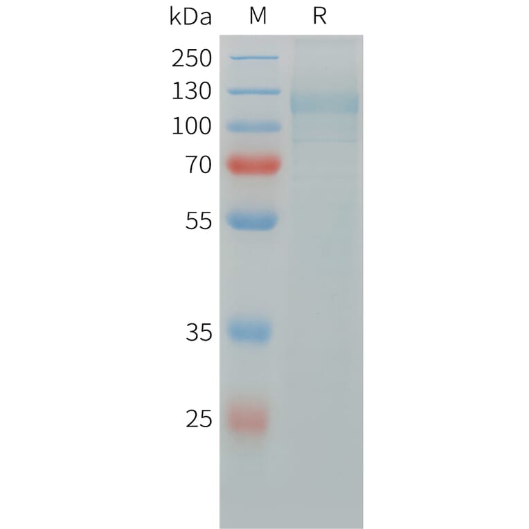 SDS-PAGE - Recombinant Human ITGAV + ITGB5 Protein (C-terminal 6xHis Tag and C-terminal hFc Tag) (A332842) - Antibodies.com