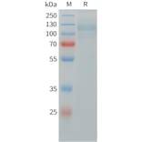 SDS-PAGE - Recombinant Human ITGAV + ITGB5 Protein (C-terminal 6xHis Tag and C-terminal hFc Tag) (A332842) - Antibodies.com