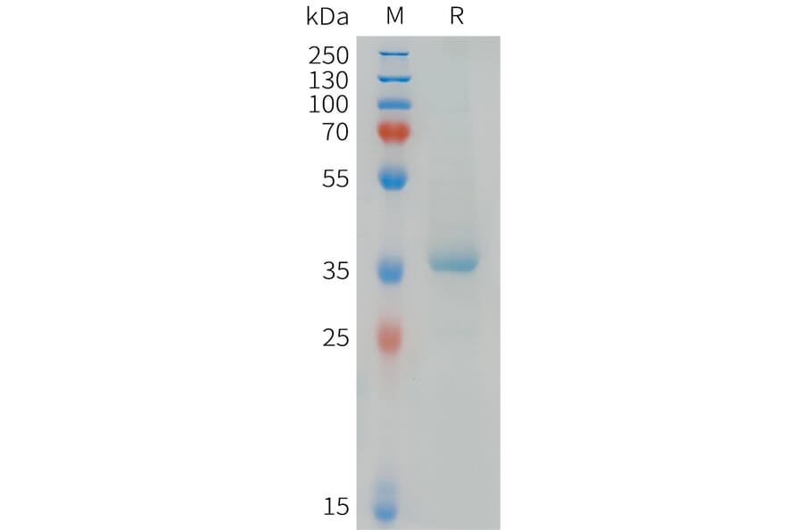 SDS-PAGE - Recombinant Human MDC Protein (C-terminal hFc Tag) (A332843) - Antibodies.com
