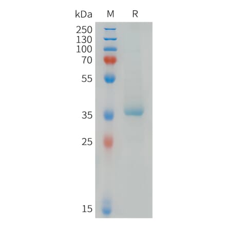 SDS-PAGE - Recombinant Human MDC Protein (C-terminal hFc Tag) (A332843) - Antibodies.com