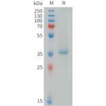 SDS-PAGE - Recombinant Human MDC Protein (C-terminal hFc Tag) (A332843) - Antibodies.com