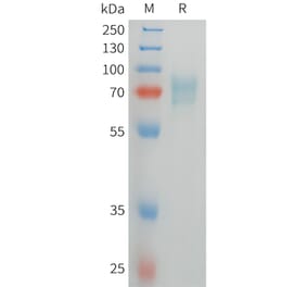 SDS-PAGE - Recombinant Human CD105 Protein (C-terminal 6xHis Tag) (A332844) - Antibodies.com