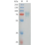 SDS-PAGE - Recombinant Human CD105 Protein (C-terminal 6xHis Tag) (A332844) - Antibodies.com