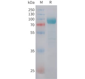 SDS-PAGE - Recombinant Human DKK3 Protein (C-terminal hFc Tag) (A332846) - Antibodies.com
