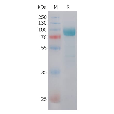 SDS-PAGE - Recombinant Human DKK3 Protein (C-terminal hFc Tag) (A332846) - Antibodies.com
