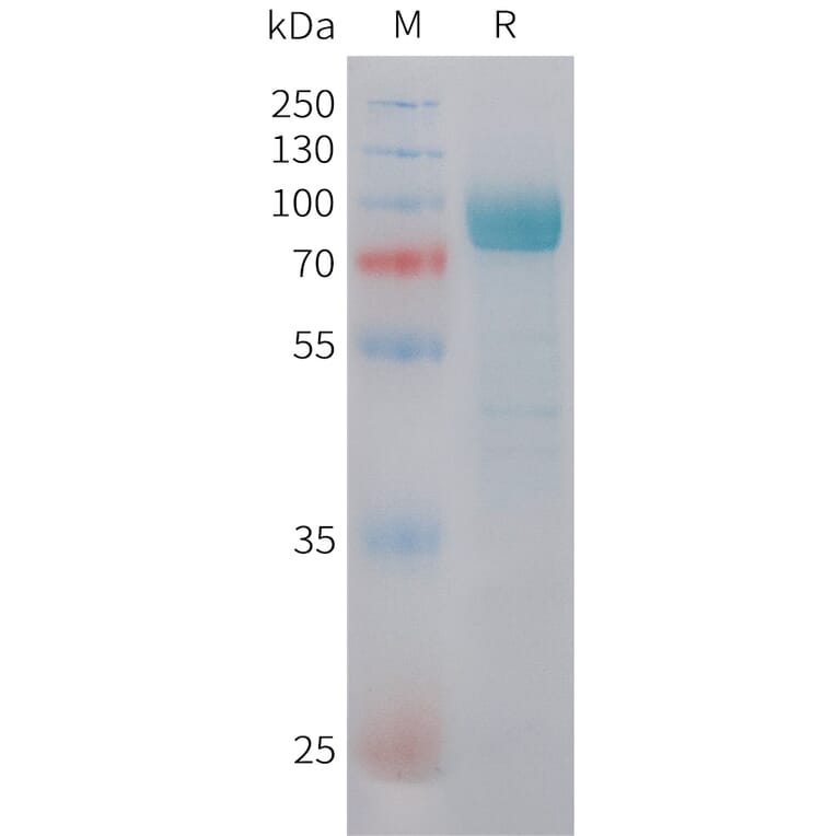SDS-PAGE - Recombinant Human DKK3 Protein (C-terminal hFc Tag) (A332846) - Antibodies.com