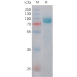 SDS-PAGE - Recombinant Human DKK3 Protein (C-terminal hFc Tag) (A332846) - Antibodies.com