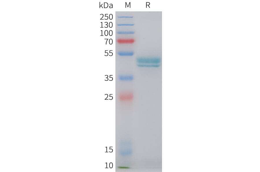 SDS-PAGE - Recombinant Human HE4 Protein (C-terminal hFc Tag) (A332848) - Antibodies.com