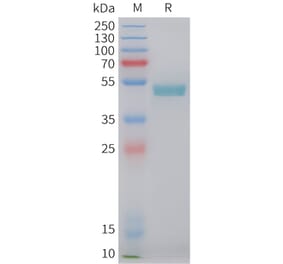 SDS-PAGE - Recombinant Human LAIR2 Protein (C-terminal hFc Tag) (A332849) - Antibodies.com