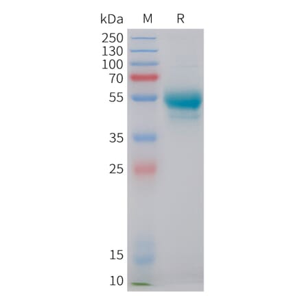 SDS-PAGE - Recombinant Human IL-7 Protein (C-terminal hFc Tag) (A332850) - Antibodies.com