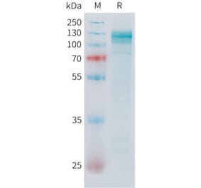 SDS-PAGE - Recombinant Human ADAM17 Protein (C-terminal hFc Tag) (A332852) - Antibodies.com