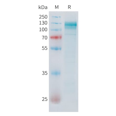 SDS-PAGE - Recombinant Human ADAM17 Protein (C-terminal hFc Tag) (A332852) - Antibodies.com