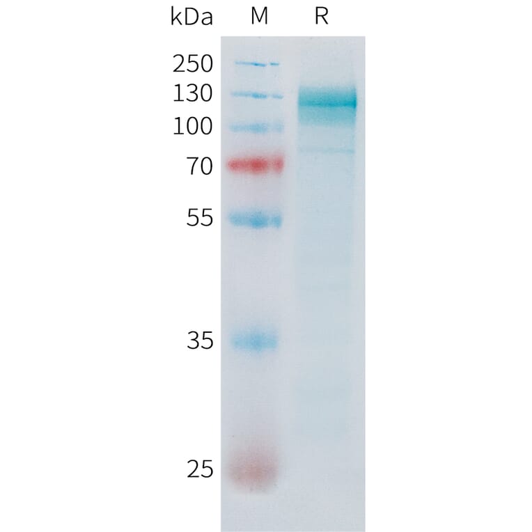 SDS-PAGE - Recombinant Human ADAM17 Protein (C-terminal hFc Tag) (A332852) - Antibodies.com