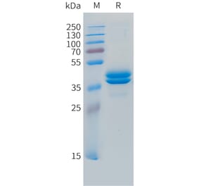 SDS-PAGE - Recombinant Human MCP3 Protein (C-terminal hFc Tag) (A332853) - Antibodies.com