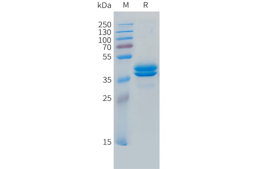 SDS-PAGE - Recombinant Human MCP3 Protein (C-terminal hFc Tag) (A332853) - Antibodies.com