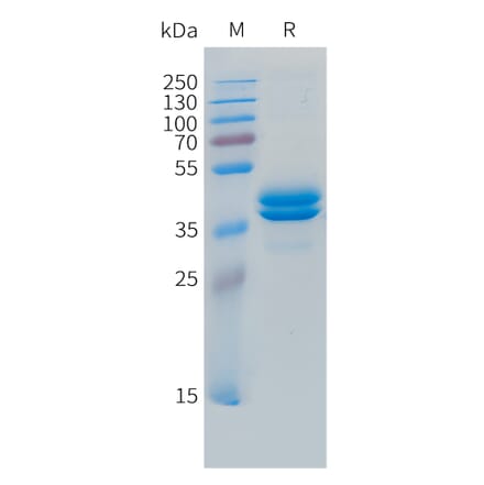 SDS-PAGE - Recombinant Human MCP3 Protein (C-terminal hFc Tag) (A332853) - Antibodies.com