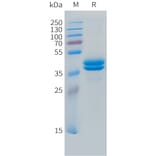 SDS-PAGE - Recombinant Human MCP3 Protein (C-terminal hFc Tag) (A332853) - Antibodies.com