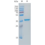 SDS-PAGE - Recombinant Human IGF2 Protein (N-terminal hFc Tag) (A332854) - Antibodies.com