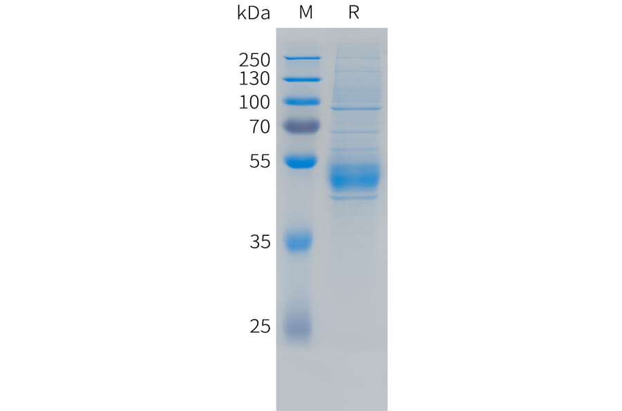 SDS-PAGE - Recombinant Human NKG2C Protein (N-terminal hFc Tag) (A332855) - Antibodies.com