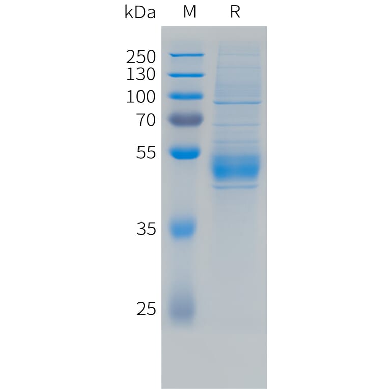 SDS-PAGE - Recombinant Human NKG2C Protein (N-terminal hFc Tag) (A332855) - Antibodies.com