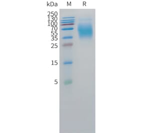 SDS-PAGE - Recombinant Human CEA Protein (C-terminal 10xHis Tag) (A332856) - Antibodies.com