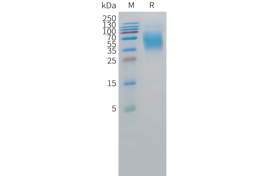 SDS-PAGE - Recombinant Human CEA Protein (C-terminal 10xHis Tag) (A332856) - Antibodies.com