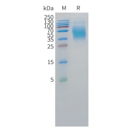 SDS-PAGE - Recombinant Human CEA Protein (C-terminal 10xHis Tag) (A332856) - Antibodies.com