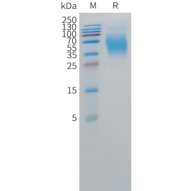 SDS-PAGE - Recombinant Human CEA Protein (C-terminal 10xHis Tag) (A332856) - Antibodies.com