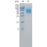 SDS-PAGE - Recombinant Human CEA Protein (C-terminal 10xHis Tag) (A332856) - Antibodies.com