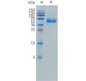 SDS-PAGE - Recombinant Human CEA Protein (C-terminal hFc Tag) (A332857) - Antibodies.com