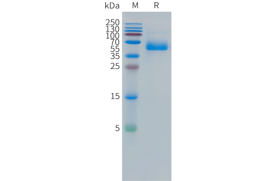 SDS-PAGE - Recombinant Human CEA Protein (C-terminal hFc Tag) (A332857) - Antibodies.com