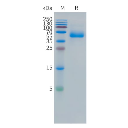 SDS-PAGE - Recombinant Human CEA Protein (C-terminal hFc Tag) (A332857) - Antibodies.com