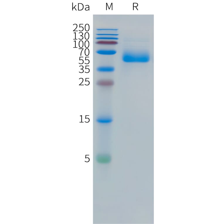SDS-PAGE - Recombinant Human CEA Protein (C-terminal hFc Tag) (A332857) - Antibodies.com