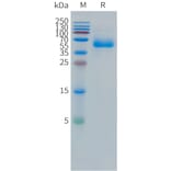 SDS-PAGE - Recombinant Human CEA Protein (C-terminal hFc Tag) (A332857) - Antibodies.com
