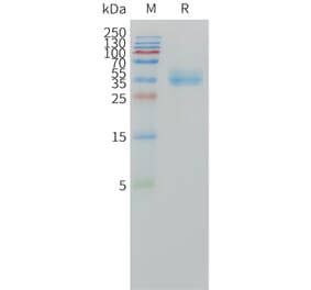 SDS-PAGE - Recombinant Human CA12 Protein (C-terminal 10xHis Tag) (A332858) - Antibodies.com