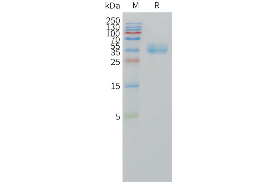 SDS-PAGE - Recombinant Human CA12 Protein (C-terminal 10xHis Tag) (A332858) - Antibodies.com