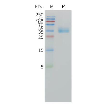SDS-PAGE - Recombinant Human CA12 Protein (C-terminal 10xHis Tag) (A332858) - Antibodies.com