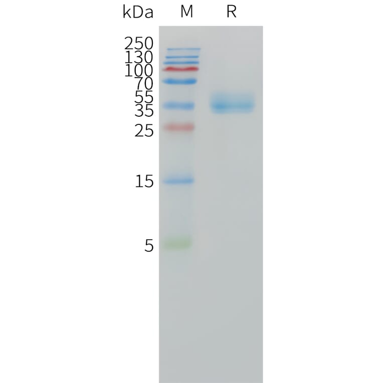 SDS-PAGE - Recombinant Human CA12 Protein (C-terminal 10xHis Tag) (A332858) - Antibodies.com