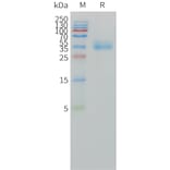 SDS-PAGE - Recombinant Human CA12 Protein (C-terminal 10xHis Tag) (A332858) - Antibodies.com