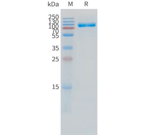 SDS-PAGE - Recombinant Human IL-1R-2 Protein (C-terminal hFc Tag) (A332860) - Antibodies.com