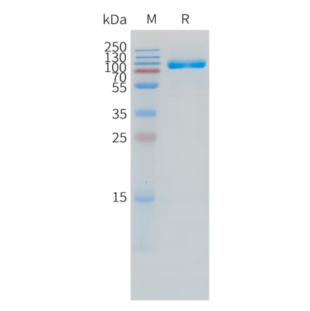 SDS-PAGE - Recombinant Human IL-1R-2 Protein (C-terminal hFc Tag) (A332860) - Antibodies.com