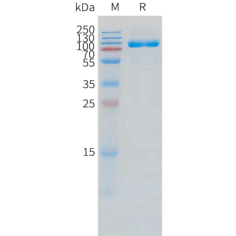SDS-PAGE - Recombinant Human IL-1R-2 Protein (C-terminal hFc Tag) (A332860) - Antibodies.com