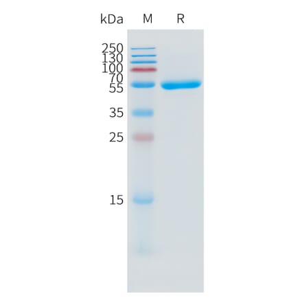 SDS-PAGE - Recombinant Human IL-1 alpha Protein (C-terminal mFc Tag) (A332861) - Antibodies.com