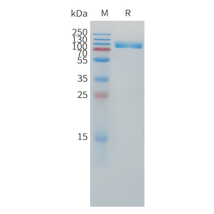 SDS-PAGE - Recombinant Human IL-1R-2 Protein (C-terminal mFc Tag) (A332862) - Antibodies.com